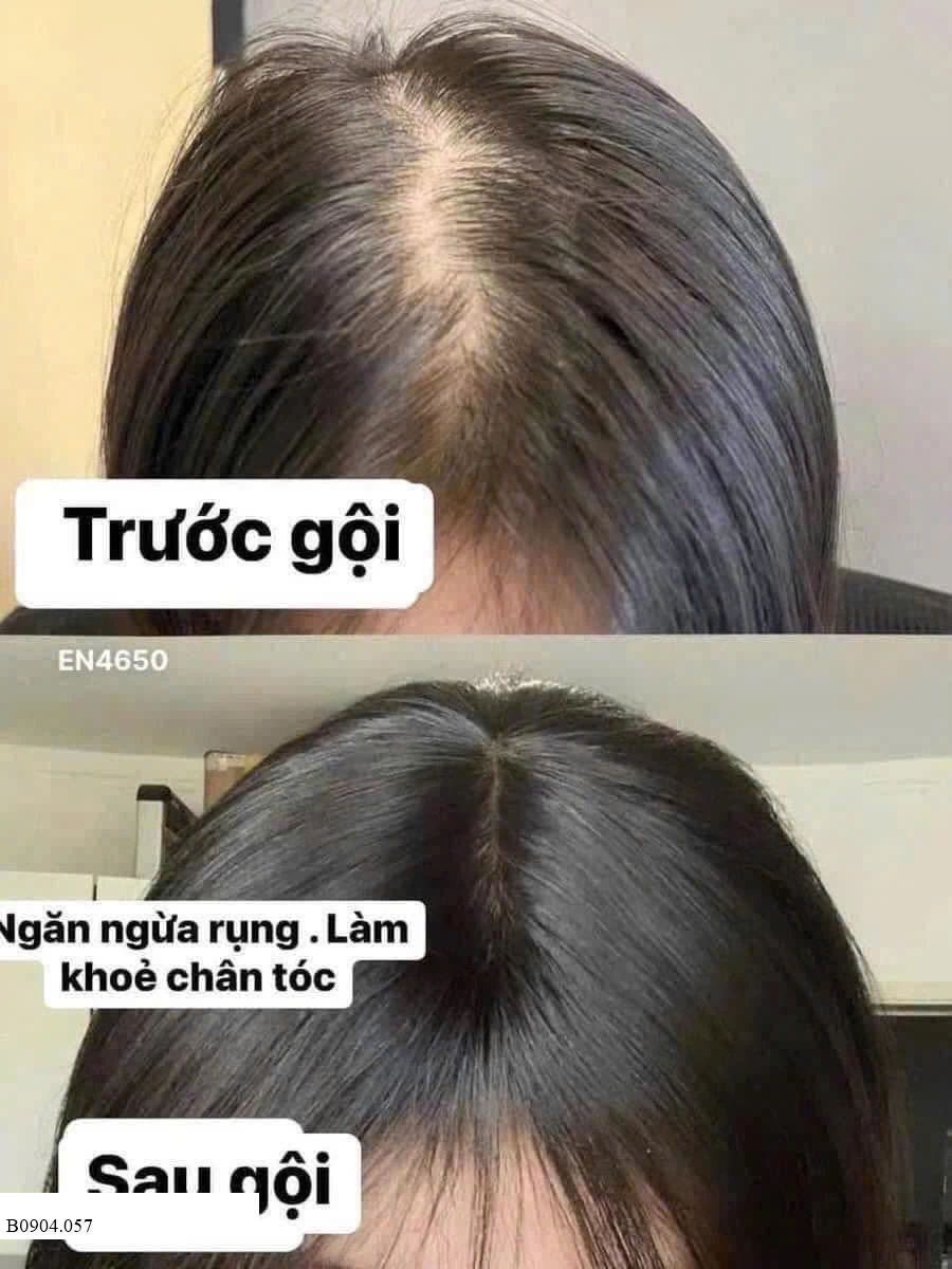 SET DẦU GỪNG CHÍNH HÃNG  Sỉ 110k/ 1 sét 2 chai
