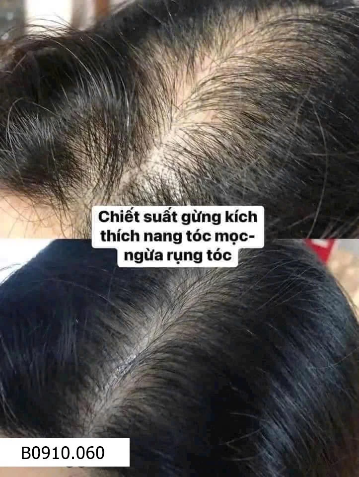 DẦU GỘI XẢ GỪNG CUZIN CHÍNH HÃNG   Giá sỉ 75k/chai