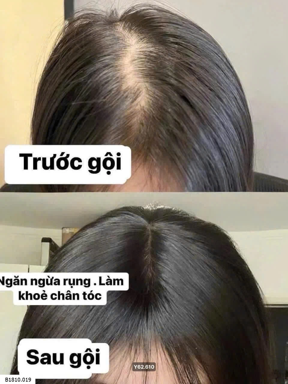 Cặp gội xả gừng ngăn rụng tóc  Giá sỉ 110k/set 1 gội+ 1 xả hoặc 2 gội.