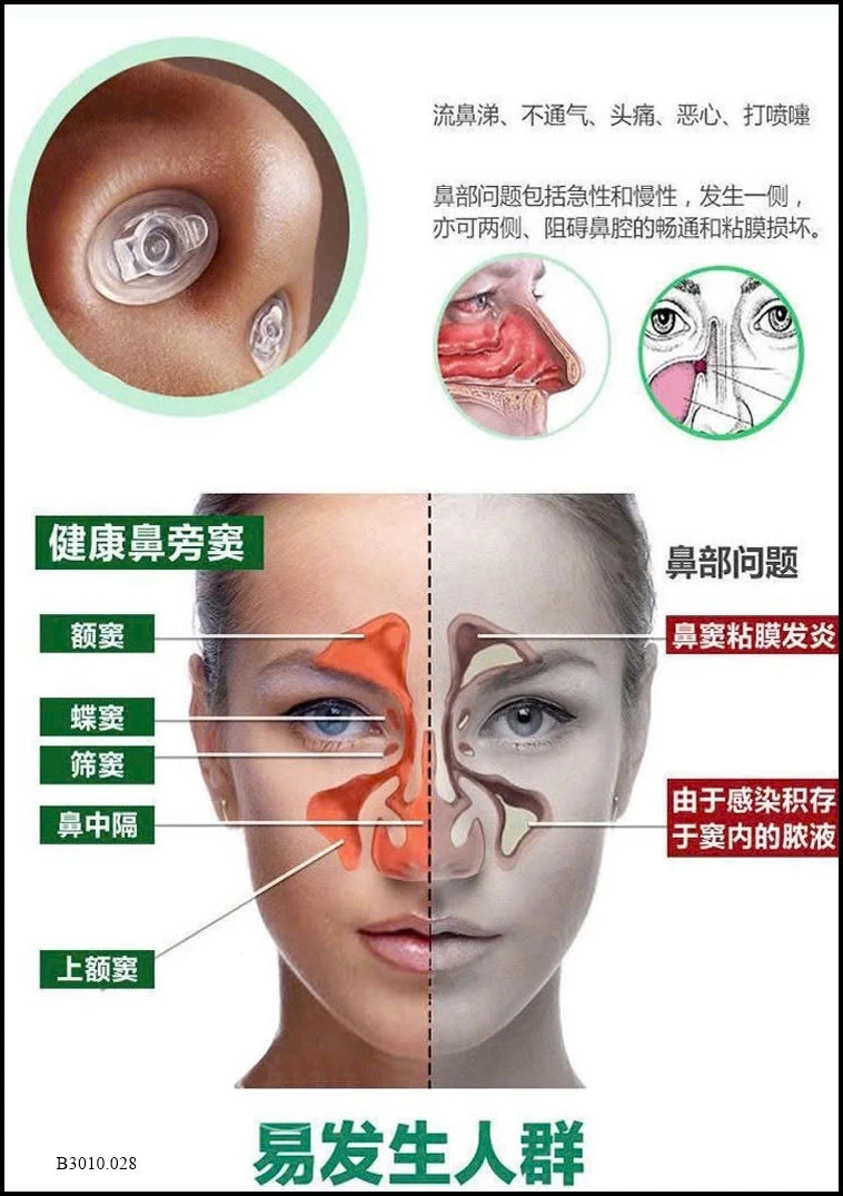 Xịt mũi thảo dược MIÊU THÁI Y   Giá sỉ 95k