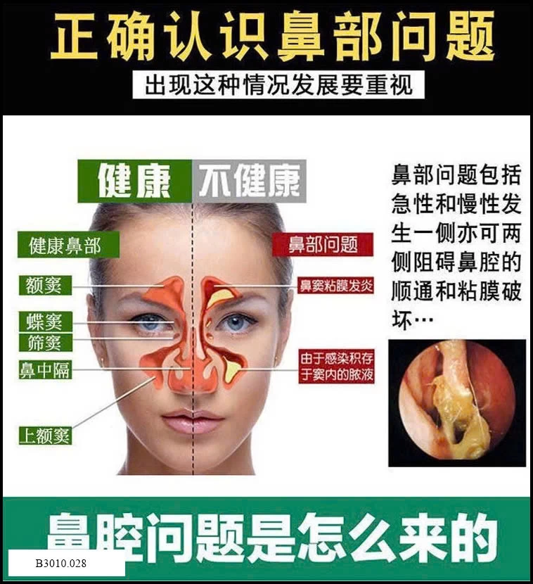 Xịt mũi thảo dược MIÊU THÁI Y   Giá sỉ 95k